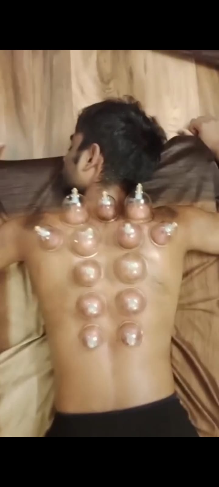 , न्यूरो फिजियोथेरेपी से कैसे लौट सकती है शरीर की ताकत?