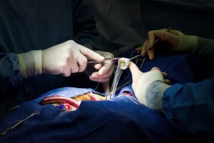 क्‍या है Open Heart Surgery, क्यों और कैसे होती है? डॉक्‍टर से जानें हर सवाल का जवाब