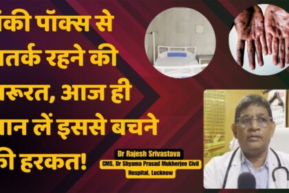 Lucknow: MonkeyPox की आहट से Hospitals सतर्क, Civil में बना Special Ward, देखें Video