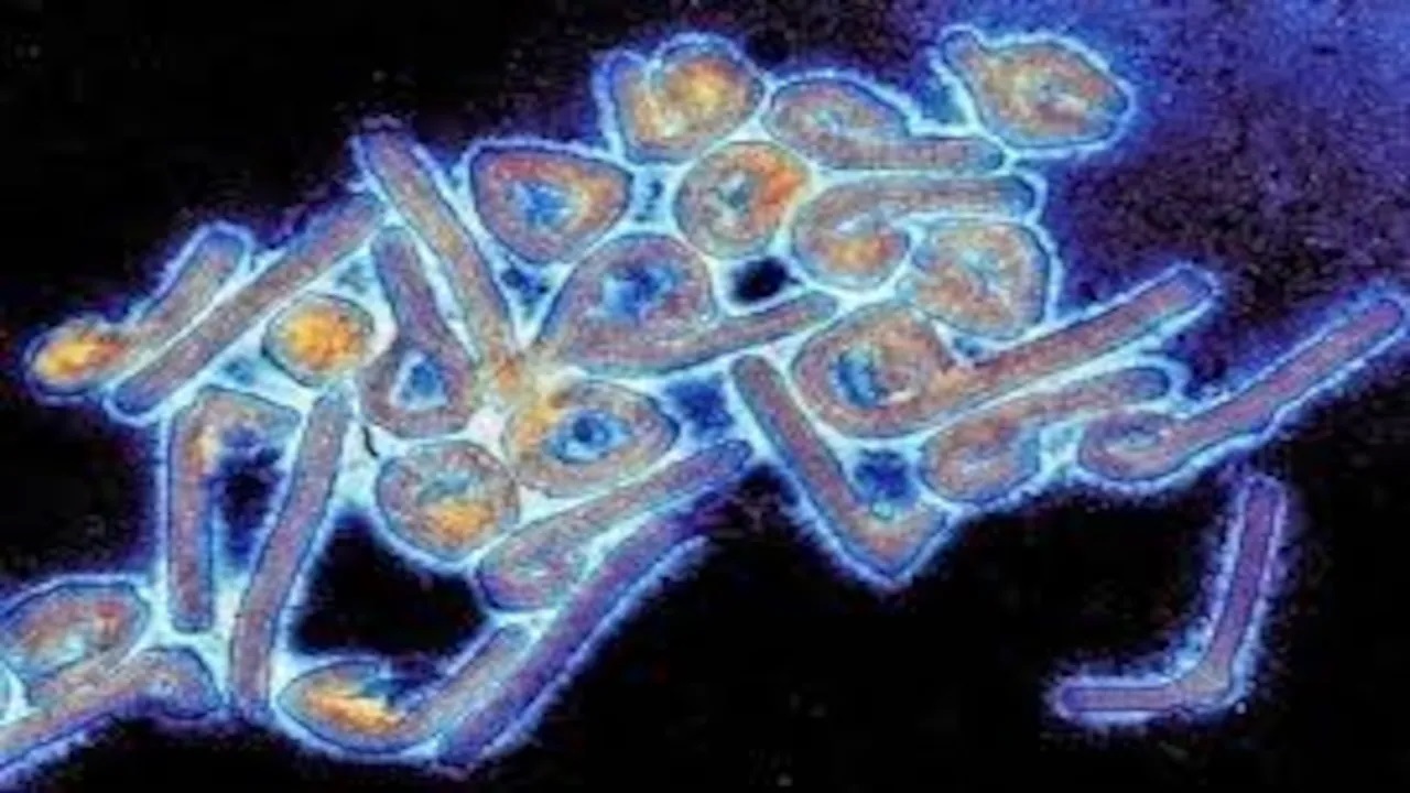दुनिया के सबसे खतरनाक Marburg Virus ने ली 12 से ज्‍यादा लोगों की जान, जानिए इसके लक्षण