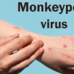 Monkeypox के केस हो रहे कम, लेकिन WHO ने फिर भी किया अलर्ट; जानिए क्‍यों?