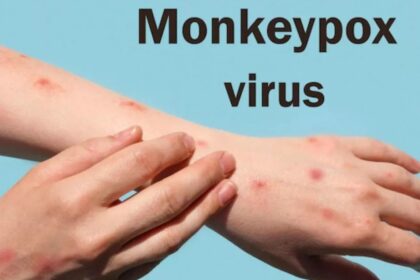 Monkeypox के केस हो रहे कम, लेकिन WHO ने फिर भी किया अलर्ट; जानिए क्‍यों?