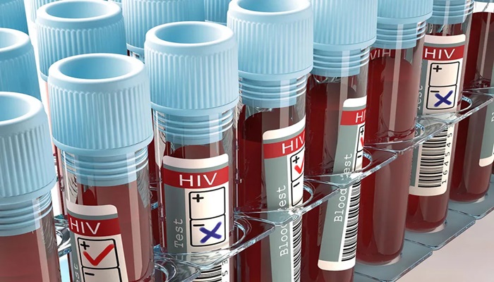 HIV & AIDS: सबसे निचले स्तर पर पहुंचे एचआईवी के मामले, जानिए कैसे मिली ये कामयाबी?