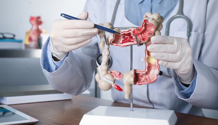 Colorectal Colon Cancer: इस खतरनाक-घातक कैंसर से बचने के लिए आहार में करें ये बदलाव