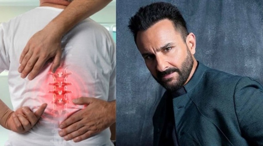 Actor Saif Ali Khan की रीढ़ की हड्डी पर लगी गहरी चोट, जानें कितनी खतरनाक हो सकती है Spinal Injury?