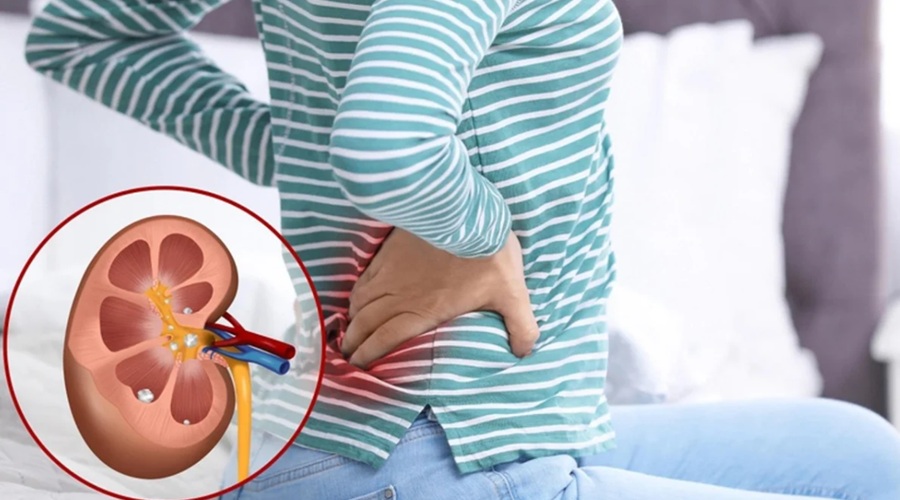 Kidney में पथरी हो या दूसरी बीमारी, ये उपाय करने से तेजी से मिलेगा फायदा