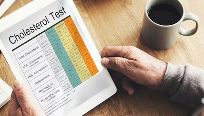 High Cholesterol में दवा की जरूरत नहीं, इन प्राकृतिक तरीकों से पाएं राहत
