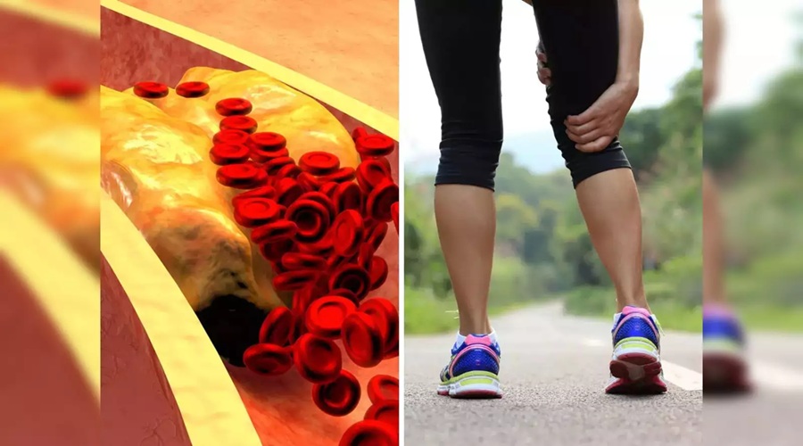 आपके शरीर में बढ़ गया है Bad Cholesterol, वॉक करने पर दिखने लगेंगे ऐसे लक्षण