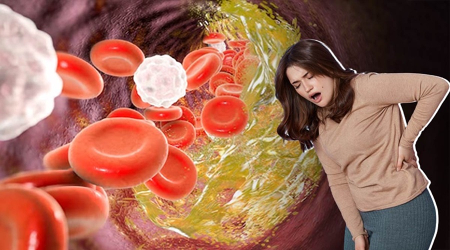 Cholesterol बढ़ने पर इन हिस्सों में होने लगता है दर्द, नजरअंदाज करना पड़ सकता है महंगा
