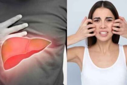 लिवर की सेहत पर खतरे का संकेत देते हैं शरीर में दिखने वाले ये कॉमन लक्षण