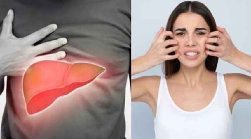 लिवर की सेहत पर खतरे का संकेत देते हैं शरीर में दिखने वाले ये कॉमन लक्षण