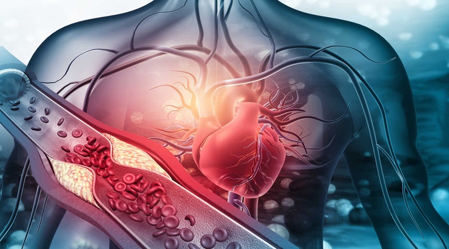 ट्राइग्लिसराइड्स भी है दिल के लिए घातक, जानिए High Triglycerides को कैसे करें कंट्रोल?
