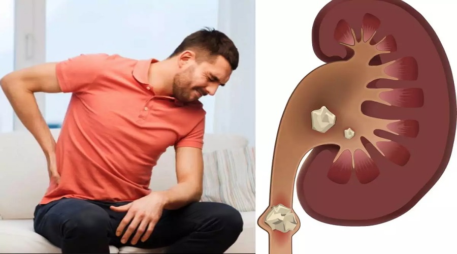 गुर्दे फेल होने में देर नहीं लगेगी, इन आदतों का Kidney पर पड़ता है बुरा असर