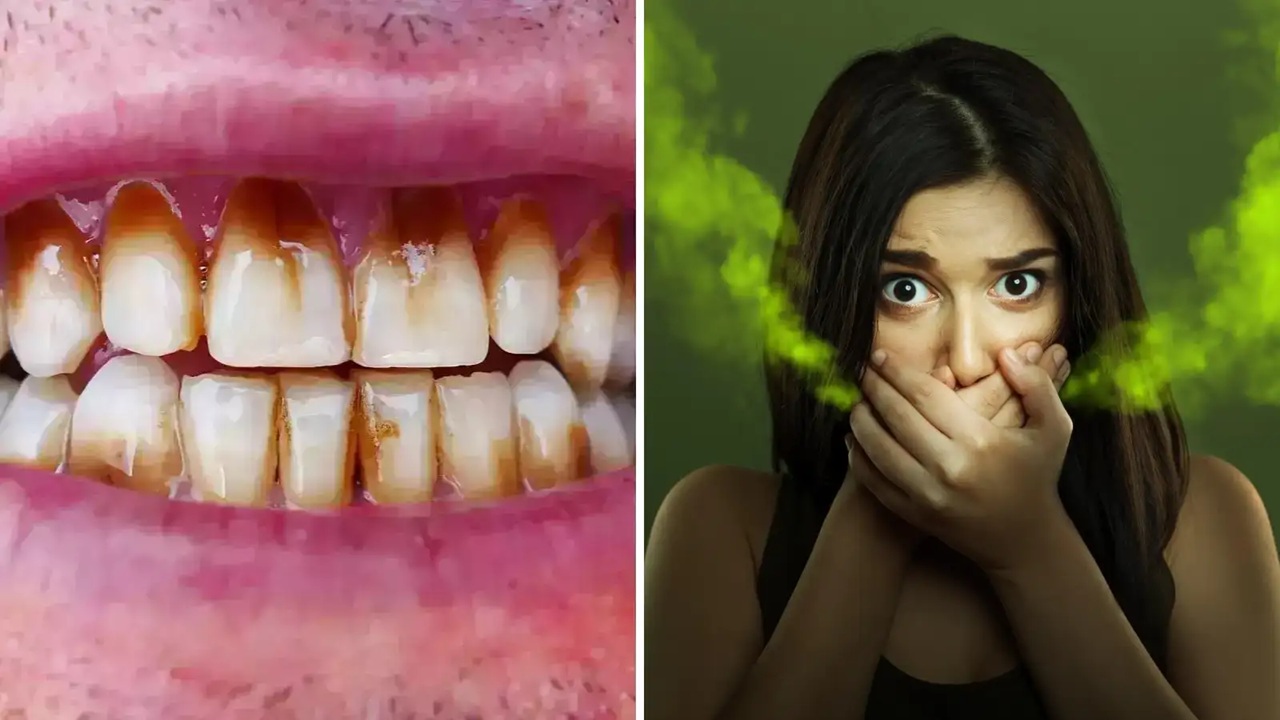 Health Tips: ओरल हेल्थ पर जरूर दीजिए ध्यान, WHO ने भी किया है सभी को सावधान