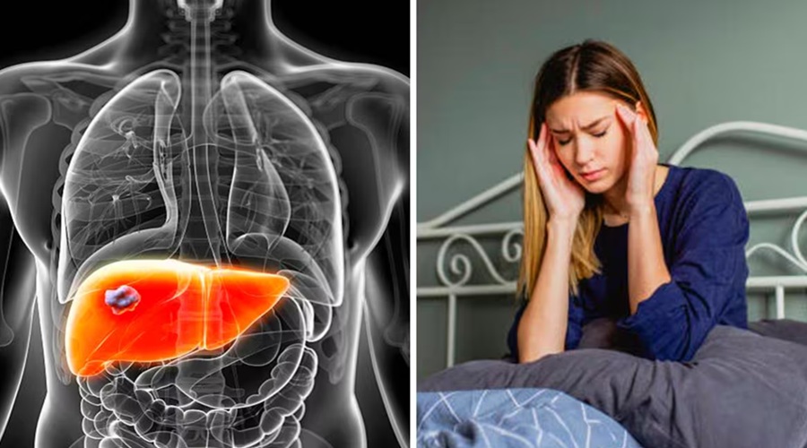 Liver Cancer हो सकता है जानलेवा, शरीर में इन लक्षणों से समझ लें है गंभीर मामला