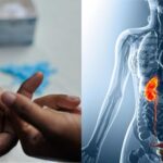 Sugar के मरीजों में बढ़ जाता है किडनी की बीमारियों का खतरा, ऐसे करें बचाव