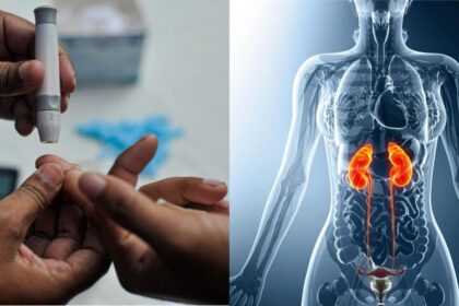 Sugar के मरीजों में बढ़ जाता है किडनी की बीमारियों का खतरा, ऐसे करें बचाव