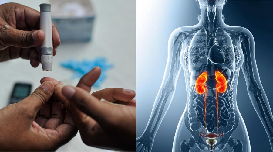 Sugar के मरीजों में बढ़ जाता है किडनी की बीमारियों का खतरा, ऐसे करें बचाव