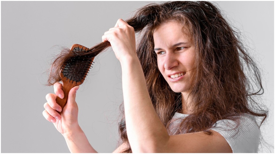 Hair Loss: जवानी में ही झड़ने लगे बाल? कहीं आप में इन विटामिन्स की कमी तो नहीं