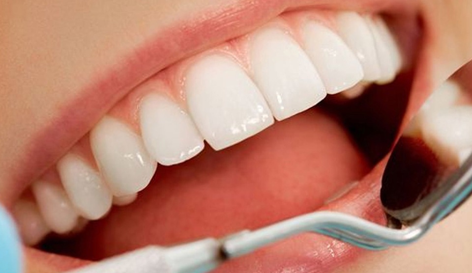 Tooth Cavity: दांत के कीड़ों को जड़ से है हटाना, इन घरेलू उपायों से जल्द मिलेगी राहत