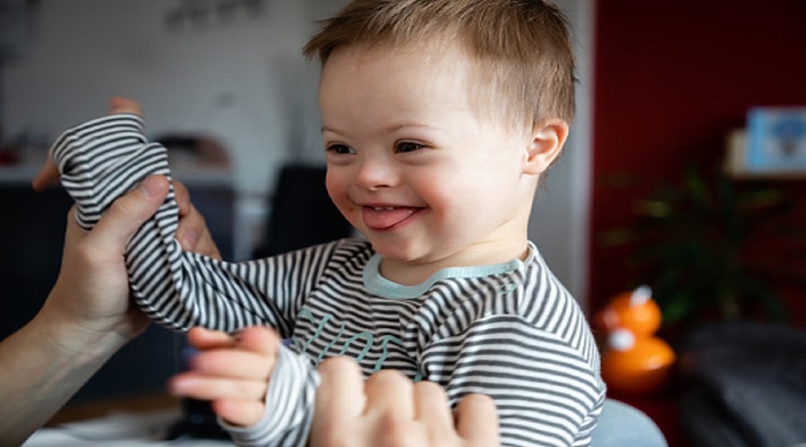 What is Down Syndrome?, जानिए लक्षण और पूरी तरह से ठीक न होने का कारण