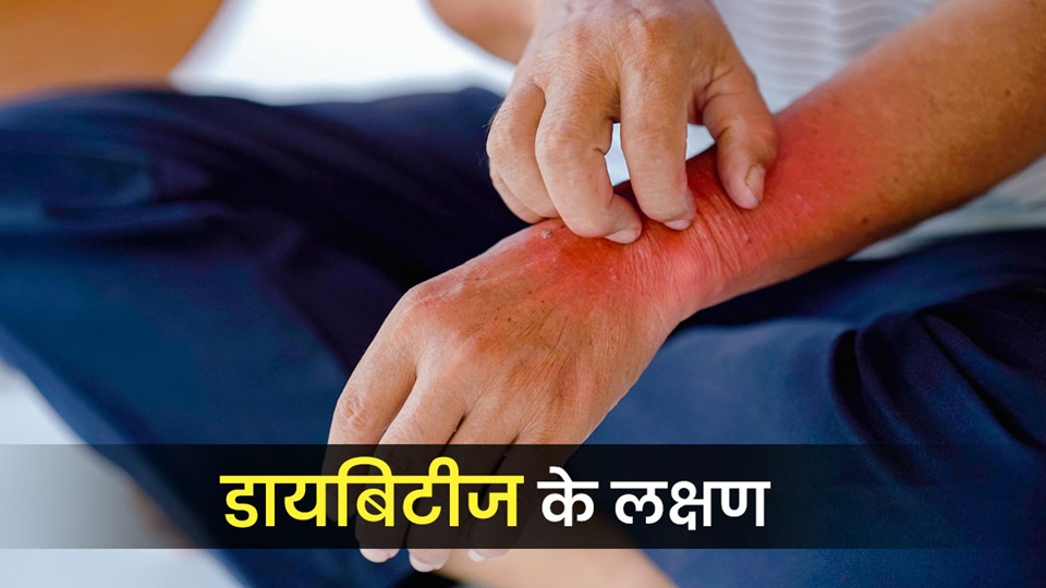 डायबिटीज के नए लक्षण, युवाओं में शुगर बढ़ने पर दिख रहे ये संकेत