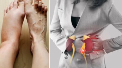 Kidney खराब होने पर पैरों में दिखने लगती है ये गंभीर परेशानी, मिलते हैं ऐसे संकेत