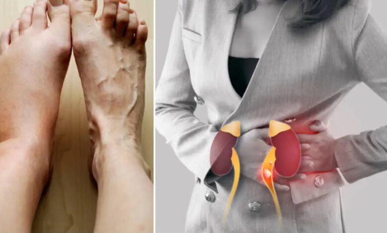 Kidney खराब होने पर पैरों में दिखने लगती है ये गंभीर परेशानी, मिलते हैं ऐसे संकेत