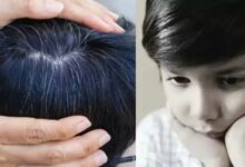 इस Vitamin की कमी से सफेद होने लगते हैं छोटे बच्चों के बाल, ये लापरवाहियां न करें पेरेंट्स