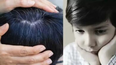 इस Vitamin की कमी से सफेद होने लगते हैं छोटे बच्चों के बाल, ये लापरवाहियां न करें पेरेंट्स
