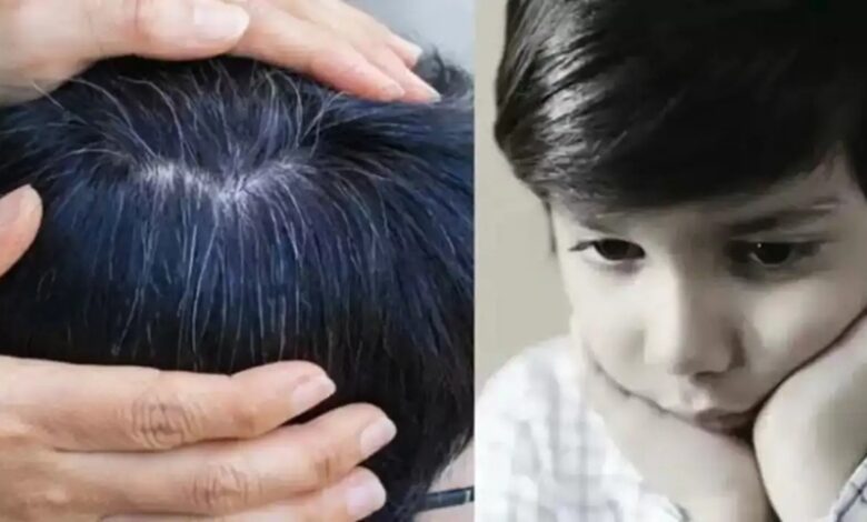 इस Vitamin की कमी से सफेद होने लगते हैं छोटे बच्चों के बाल, ये लापरवाहियां न करें पेरेंट्स