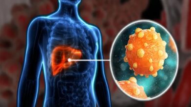 कितना खतरनाक होता है Hepatitis, जानिए लक्षण, कारण और बचाव के तरीके?