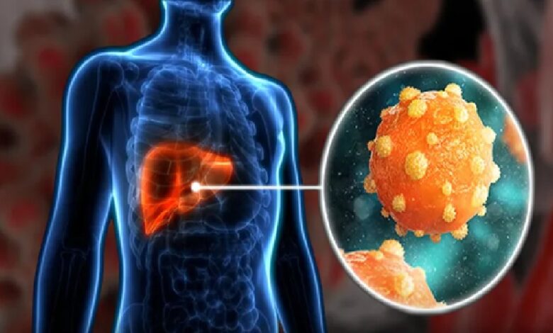 कितना खतरनाक होता है Hepatitis, जानिए लक्षण, कारण और बचाव के तरीके?