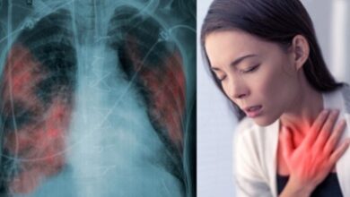 Stage 1 Lung Cancer की ओर इशारा करते हैं ये लक्षण, जानकर हो जाएं सावधान!