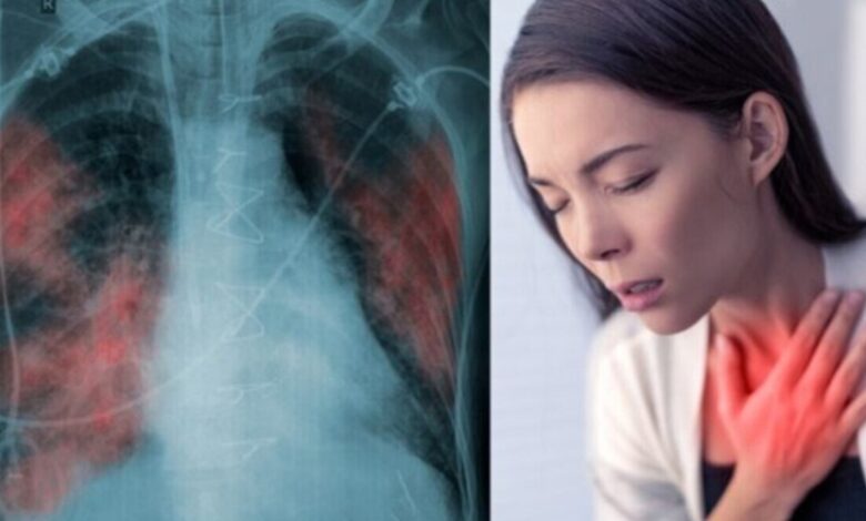 Stage 1 Lung Cancer की ओर इशारा करते हैं ये लक्षण, जानकर हो जाएं सावधान!