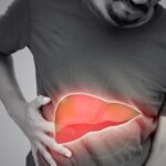 Fatty Liver है असली दुश्मन! इन एक्सरसाइज से खुद चेक करें अपनी फिटनेस
