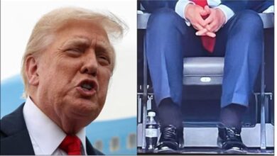 American President Donald Trump को हुई नसों की ये बीमारी, हाथ पैरों पर दिखाई देने लगे लक्षण