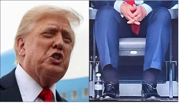 American President Donald Trump को हुई नसों की ये बीमारी, हाथ पैरों पर दिखाई देने लगे लक्षण