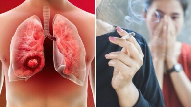 बहुत घातक साबित हो सकता है Lung Cancer, रिस्क फैक्टर्स से हो जाएं सावधान!