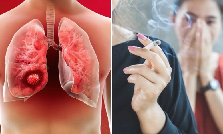 बहुत घातक साबित हो सकता है Lung Cancer, रिस्क फैक्टर्स से हो जाएं सावधान!