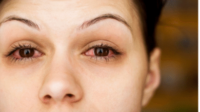 Eyes Infection: आंखों की समस्या से हैं परेशान, इन घरेलू उपायों से जल्द मिलेगा आराम