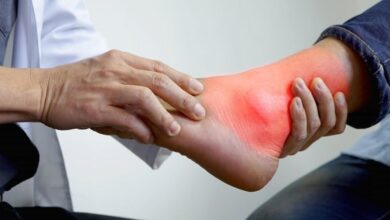 Uric Acid: शरीर के इस हिस्से में होता है दर्द, हाई यूरिक एसिड का है इशारा