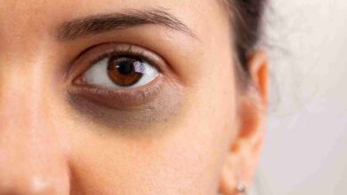 Dark Circles: आपकी आंखों के नीचे भी हो गए हैं काले धब्बे? इसको कभी न करें अनदेखा
