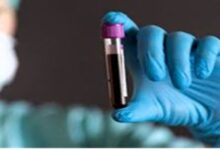 Blood Caring Tips: इसलिए गाढ़ा होने लगता है खून, बढ़ जाता है कई बीमारियों का खतरा
