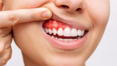 Health Tips: मसूड़ों से खून आने को हल्के में न लें, इन बीमारियों का है ये शुरुआती लक्षण