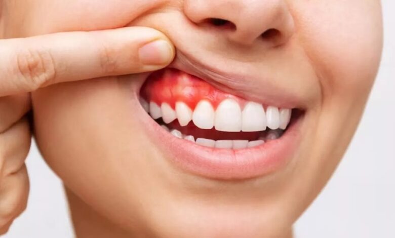 Health Tips: मसूड़ों से खून आने को हल्के में न लें, इन बीमारियों का है ये शुरुआती लक्षण