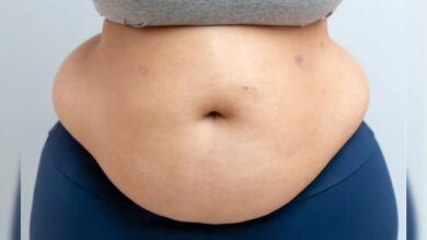 Belly Fat: निकलने लगी है तोंद? खान-पान में गड़बड़ी ही नहीं, ये भी हैं इसकी वजह