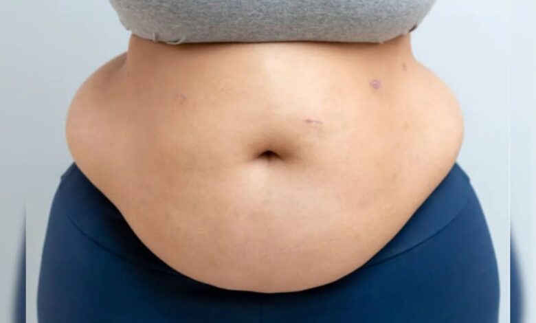Belly Fat: निकलने लगी है तोंद? खान-पान में गड़बड़ी ही नहीं, ये भी हैं इसकी वजह