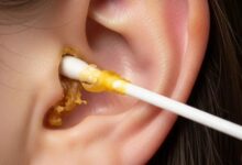 आपको परेशान कर रहा Ear Wax, जानिए कान का मैल निकालने के आसान घरेलू उपाय