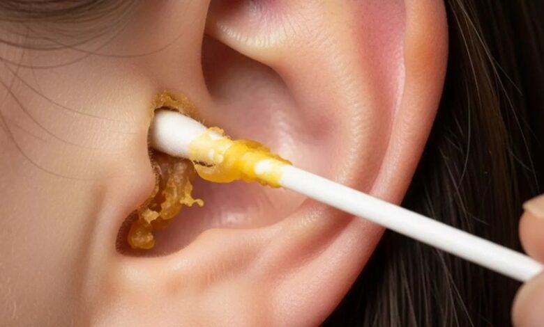 आपको परेशान कर रहा Ear Wax, जानिए कान का मैल निकालने के आसान घरेलू उपाय